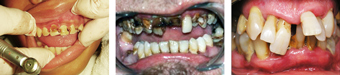 dental_problems08-07-2012.jpg
