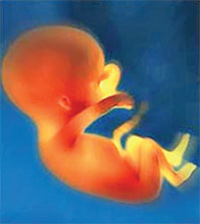 fetus_gr1.jpg