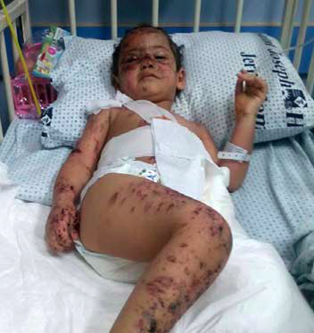 hanan_victim_of_israeli_bombs_08-12-2014_1.jpg