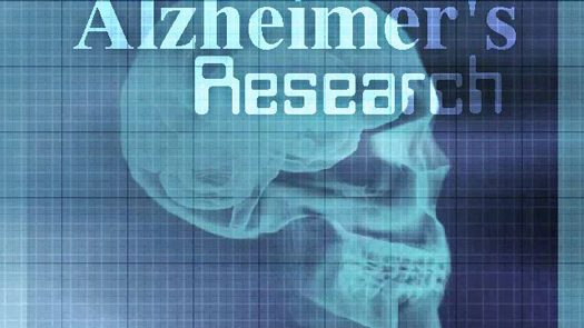 alzheimers-research.jpg