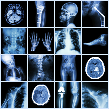 x-rays_07-18-2017.jpg